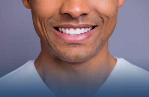 Cosmetic Dentists in Welland